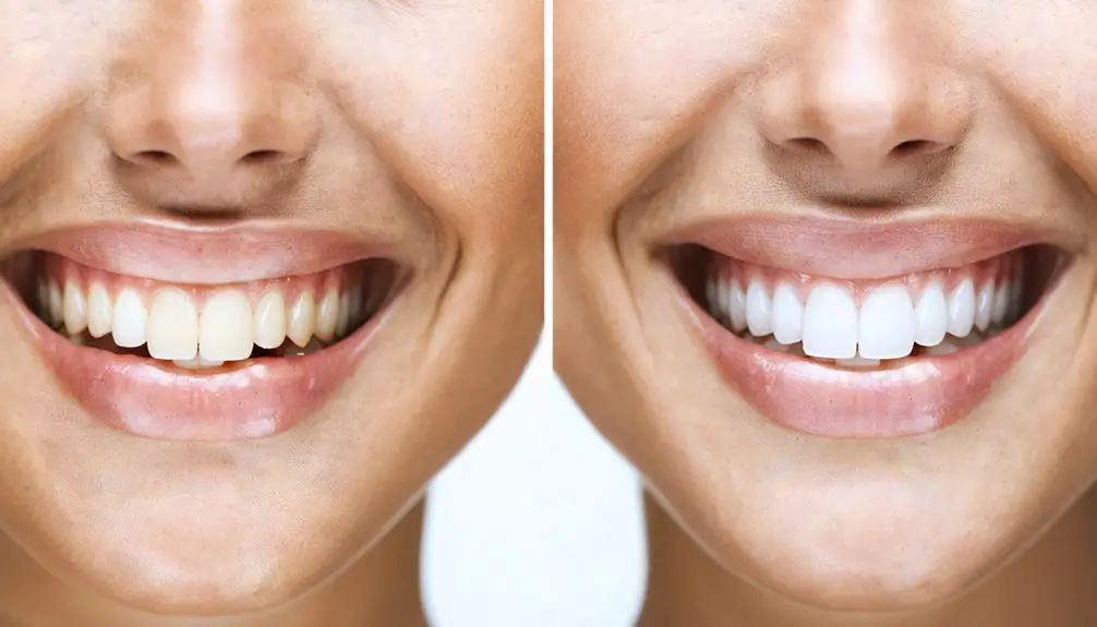 teeth whitening sensitivity management