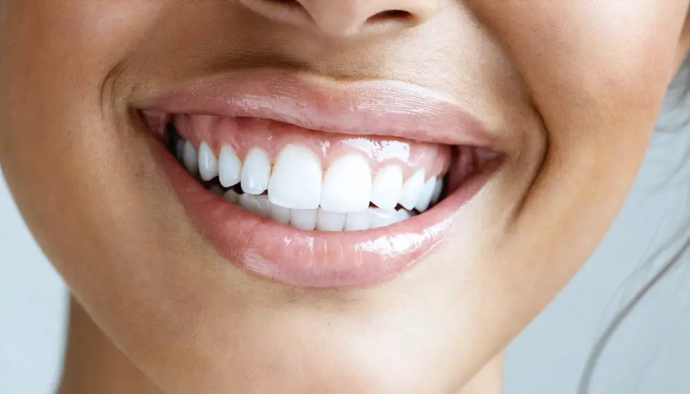 whiter smile boosts confidence