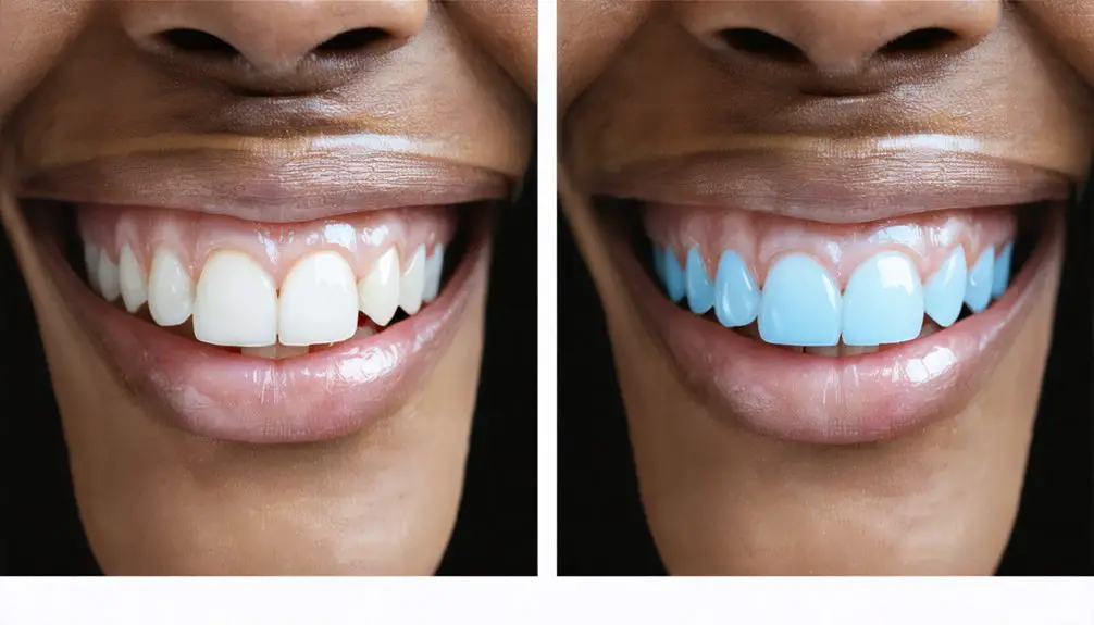 long lasting laser whitening results