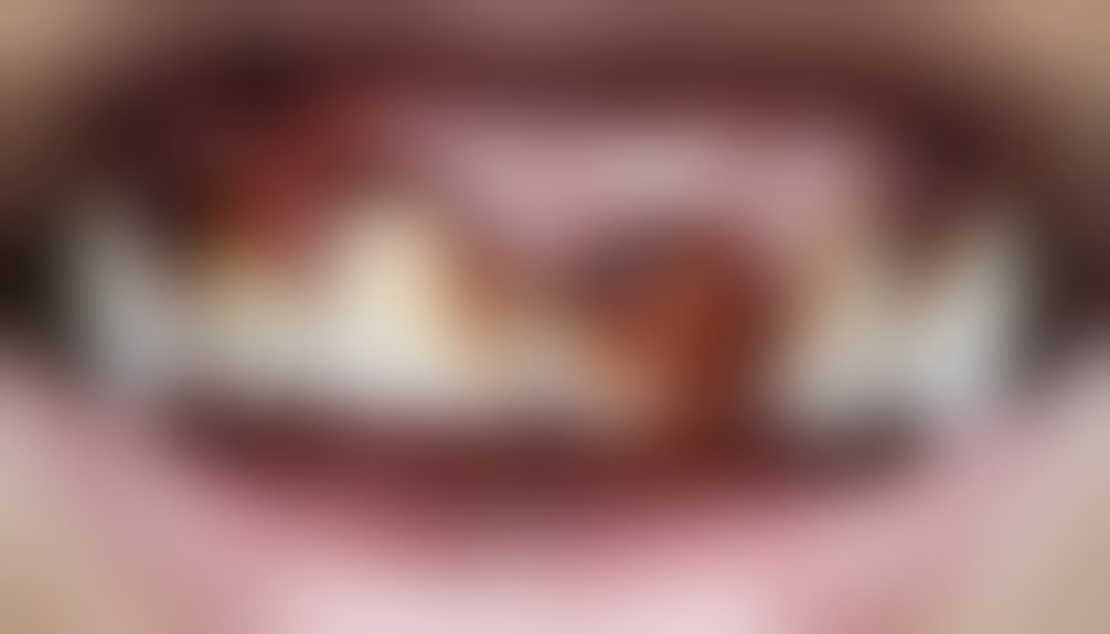 gum disease exacerbates discoloration