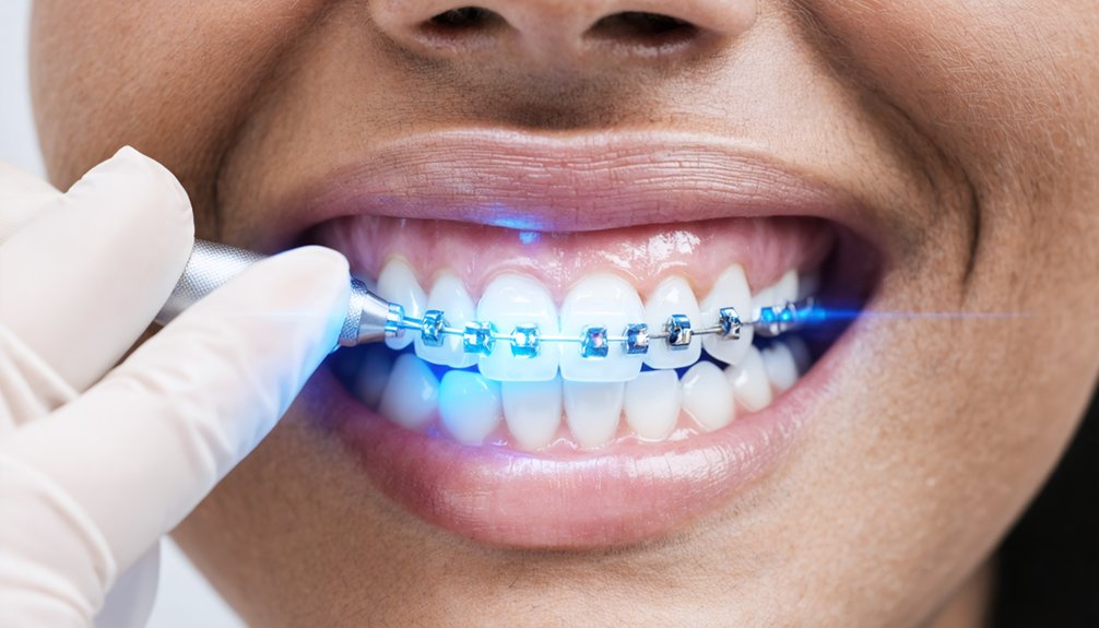 top braces teeth whitening